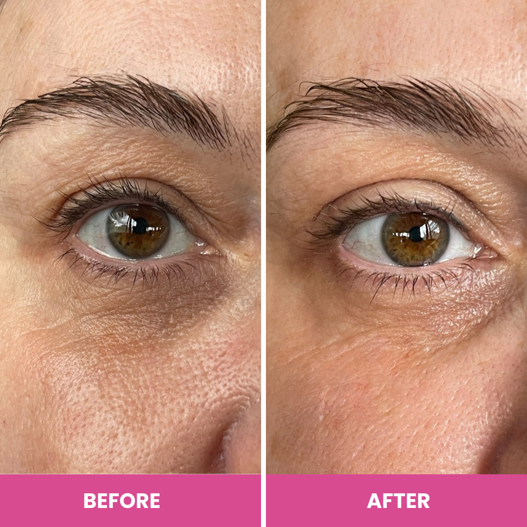 PrimeEyes Hydrate