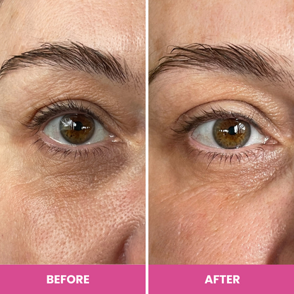 PrimeEyes Hydrate